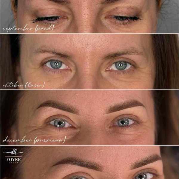 oprava - laser - powder brows permanentný makeup